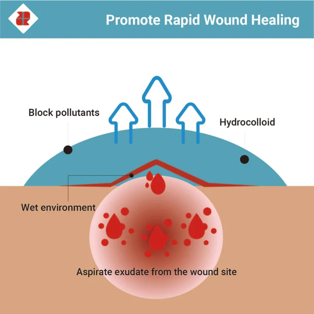 Hydrocolloid Roll for Acne, Bacne, Ezcema and wounds