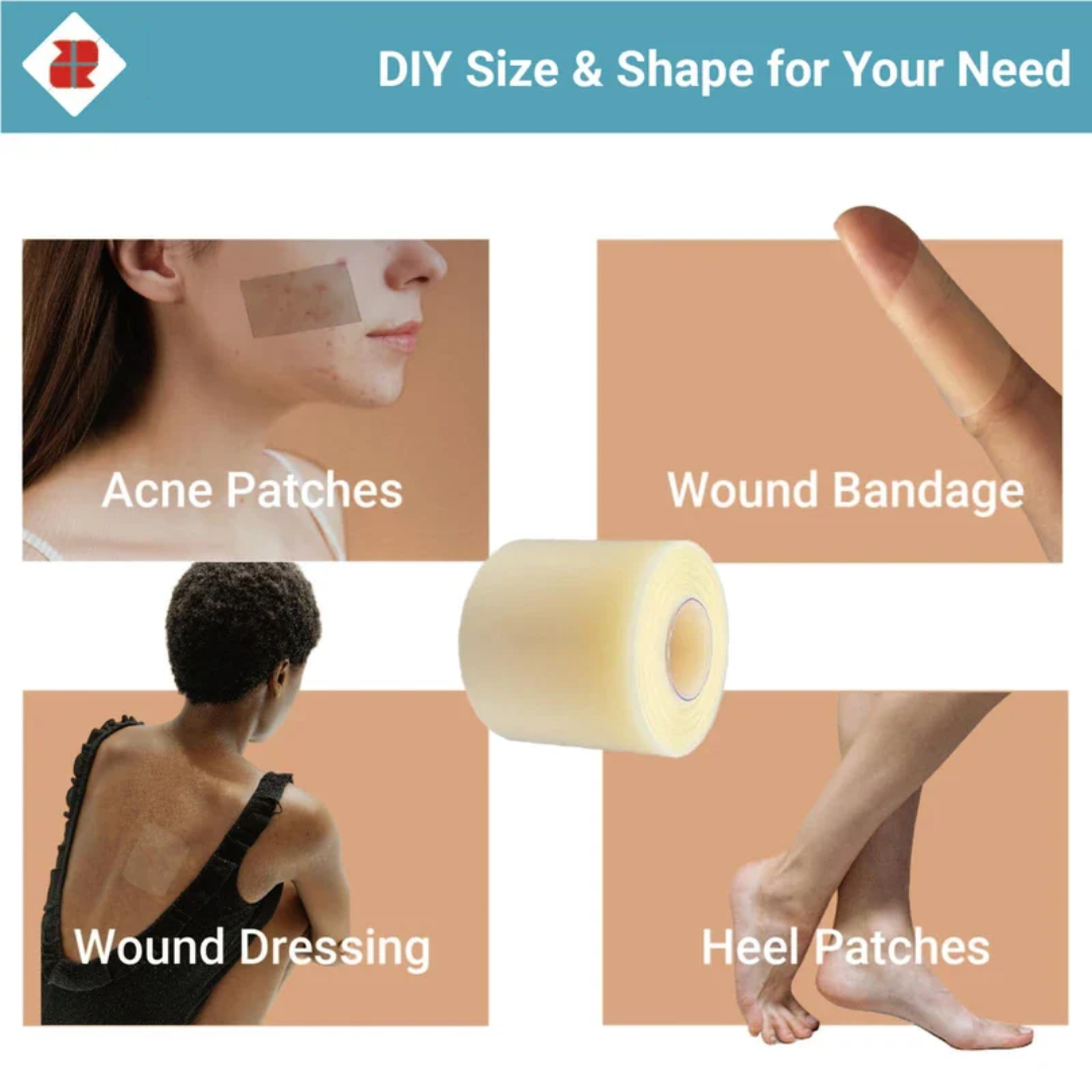 Hydrocolloid Roll for Acne, Bacne, Ezcema and wounds
